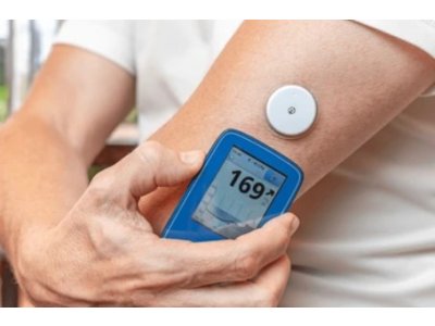 Kontinuální monitoring glykémie